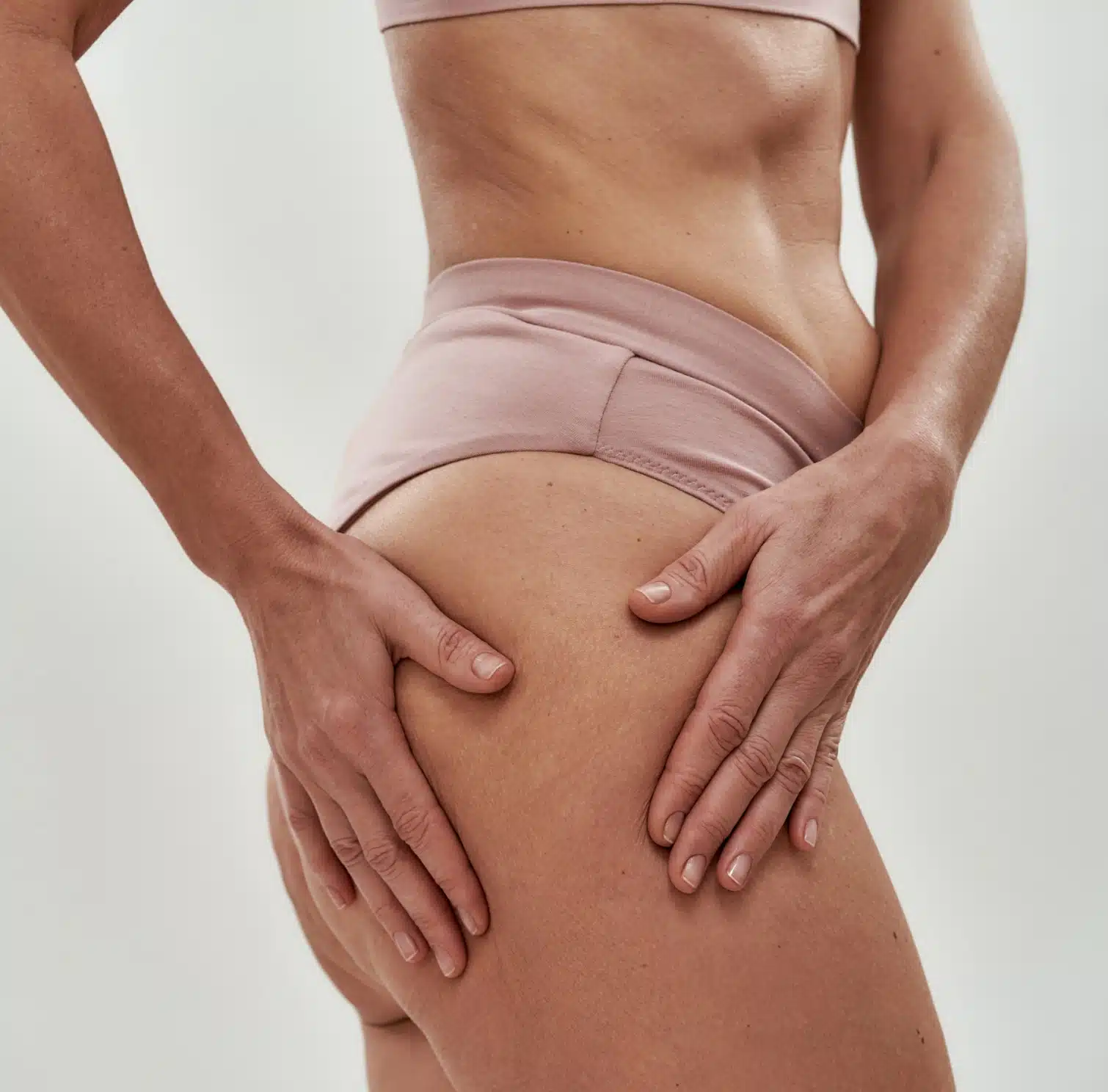 Liposuccion culotte de cheval à Bordeaux | chirurgie esthétique culotte de cheval | Dr Fiona Goldammer